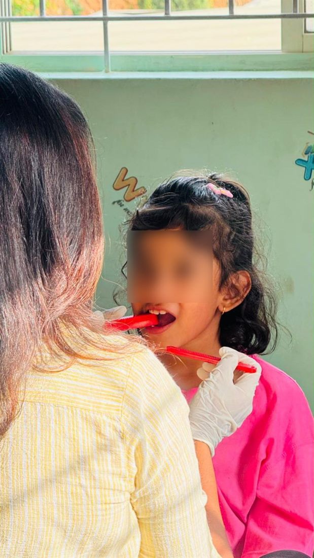Oral placement therapy session
